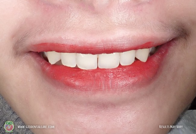 get-your-smile-here--1